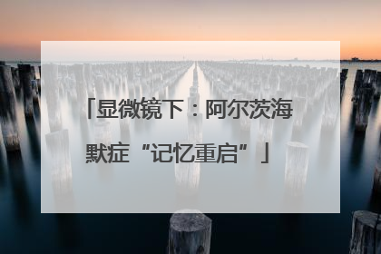 显微镜下：阿尔茨海默症“记忆重启”